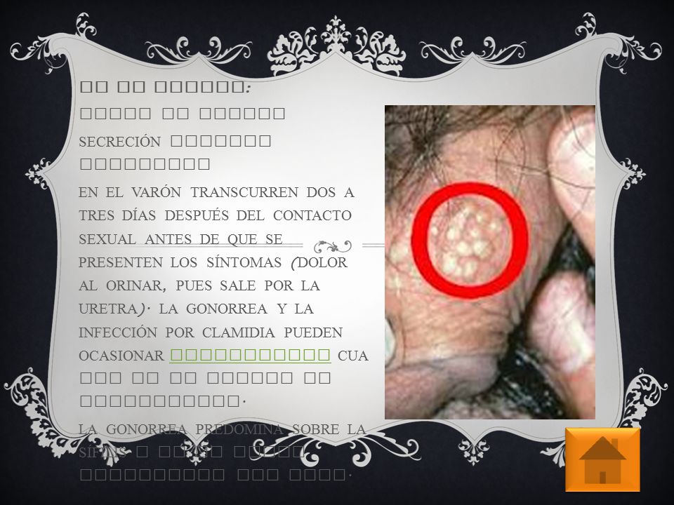 uretritis en el borde de los hombres